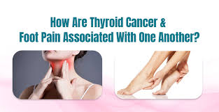 thyroid cancer cause thyroid foot pain