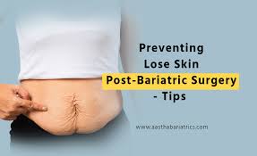 preventing lose skin post bariatric