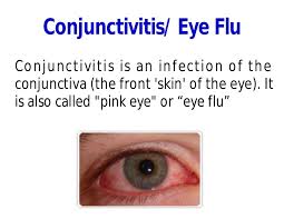 Eye floaters are basically floating debris in your eyes. Eye Flu