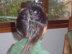 treatment head lice