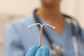 can you remove your iud yourself