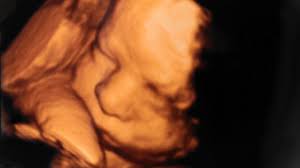 Ein unvergessliches, bewegendes erlebnis für werdende mütter und väter ist ein 3d ultraschall bild ihres babys. 3d Ultraschall Warum Ist Er Jetzt Verboten Hallo Eltern