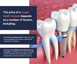 how much is a single tooth implant