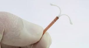do copper iud users experience weight gain