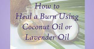 a burn using coconut oil or lavender oil