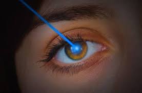 Laser eye surgery is suitable for most people over 18. Lasik Surgery Definition Procedure Results