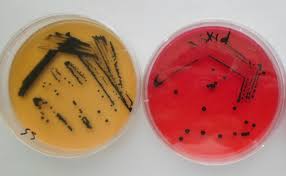 Salmonella typhimurium on xld agar. Typical Salmonella Colonies On Salmonella Shigella Agar And Download Scientific Diagram