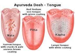 Ayurvedic Tongue Dosha Diagnosis Chart Ayurvedic Healing