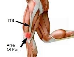 knee pain from running causes