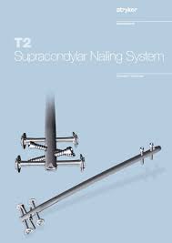 t2 supracondylar nailing system stryker