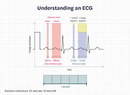 how to calculate heart rate from ecg