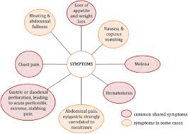 some common symptoms of ulcer