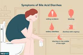 bile acid diarrhea and malabsorption