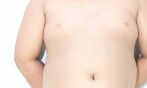 أسباب و علاج التثدي عند الرجال | Yetkin Bayer