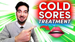 cold sore on lip and treatment