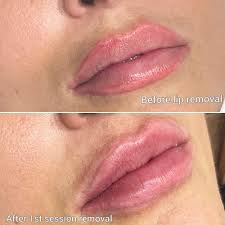 how long do lip tattoos last and how