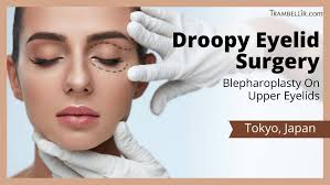 droopy eyelid surgery blepharoplasty