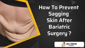 how to prevent sagging skin after
