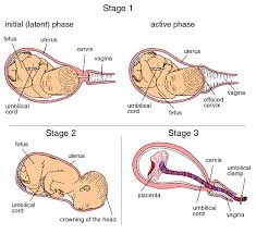 Stages Of Labor Chart Dare Alla Luce Doula