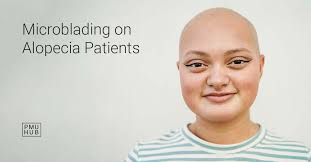 microblading for alopecia patients