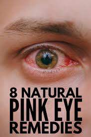 home remes for pink eye 8 natural