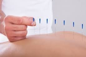 Only three canadian provinces ask that students meet licensing requirements to work as an acupuncturist, but all provinces require some training in the field. Academy Foundations International Academy Of Applied Health