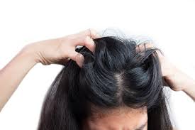 scalp dermais signs and symptoms of