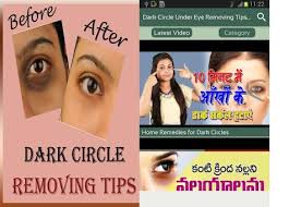 dark circle under eye removing tips
