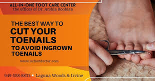 cut your toenails to avoid ingrown toenails
