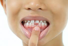 This will help the tooth gradually come out naturally. Pull A Loose Tooth The Easy Way