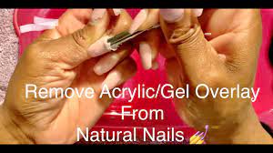 removing acrylic overlay on natural