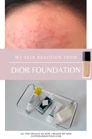 dior forever foundation allergic
