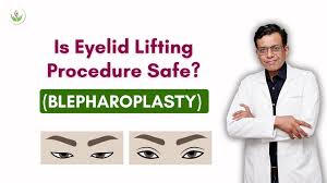is eyelid lifting blepharoplasty