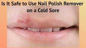 nail polish remover on a cold sore