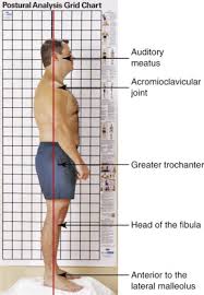 Postural Assessment An Overview Sciencedirect Topics