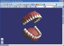Dental Patient Charting Software Management Tools Dentrix