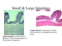 The average american diet can wreck havoc on the intestinal system. Small Large Intestines Ppt Video Online Download