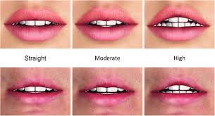 lip form for each straight