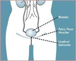 pelvic floor stimulation therapy in the