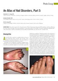 pdf an atlas of nail disorders part 5