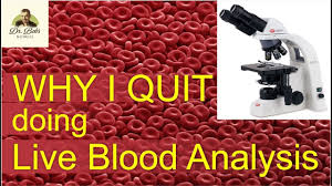 Why I Stopped Doing Live Blood Analysis Dr Bob Mccauleys