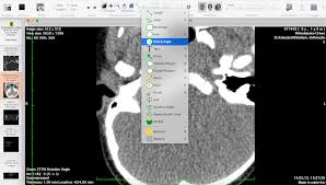 The dicom image viewer window is manually adjustable and a series of multiple images can be played in loop. Top 25 Free Dicom Viewers For Doctors Medical Students And Health Professionals Postdicom