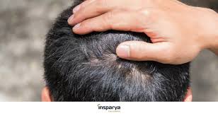itchy and painful irritated scalp