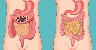 Advertisement colon cancer is the third most deadly form of cancer for men and women. 7 Safe Ways To Cleanse Your Colon And Preserve Your Youth