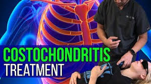 5 natural remedies for costochondritis symptoms. Costochondritis Treatment Chest Sternum And Rib Pain Relief Youtube
