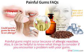 painful gums faqs shecares