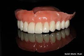 Koje vrste krunica za zube postoje. Vrste I Cijene Zubnih Proteza Dental Estetic Studio