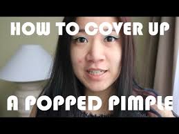 cover up a popped pimple