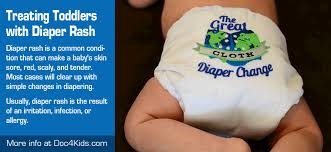 treating toddlers with diaper rash