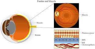 IJMS | Free Full-Text | Age-Related Macular Degeneration: Role of Oxidative  Stress and Blood Vessels